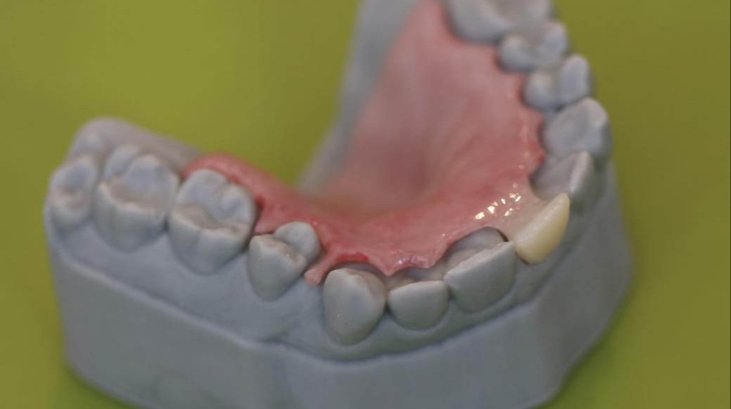 Tooth plate